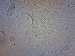 メガバクテリア（セキセイインコ）.jpg